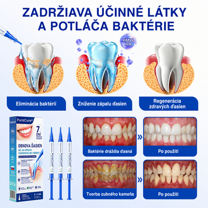 👨‍⚕️🦷𝑷𝒖𝒓𝒂𝑪𝒖𝒓𝒆® 𝑶𝑩𝑵𝑶𝑽𝑨 Ď𝑨𝑺𝑰𝑬𝑵 𝑷𝒂𝒓𝒐𝒅𝒐𝒏𝒕á𝒍𝒏𝒚 𝒐𝒑𝒓𝒂𝒗𝒏ý 𝒈é𝒍✨
