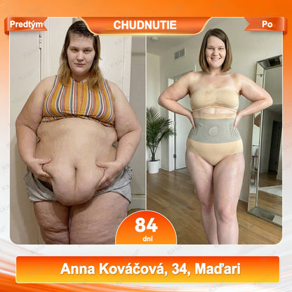Objavte tajomstvo – Kkio® 4 v 1 tvarovacie a spaľovačské kraťasy s mikronizovanou moringou a borberínom 🔥🔥