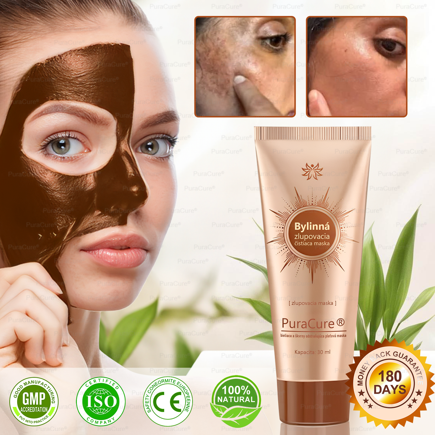 💟𝗣𝘂𝗿𝗮𝗖𝘂𝗿𝗲® Bieliaca a zosvetľujúca maska na tvár | Prírodné zložky, ktoré dlhodobo odstraňujú pigmentové škvrny, pehy a slnečné škvrny🌿🌿