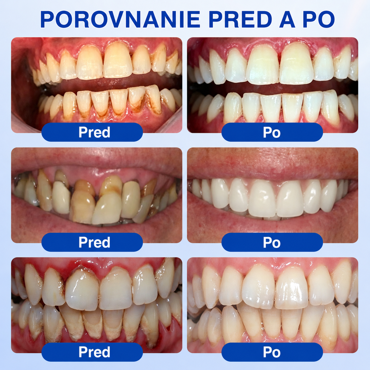 👨‍⚕️🦷𝑷𝒖𝒓𝒂𝑪𝒖𝒓𝒆® 𝑶𝑩𝑵𝑶𝑽𝑨 Ď𝑨𝑺𝑰𝑬𝑵 𝑷𝒂𝒓𝒐𝒅𝒐𝒏𝒕á𝒍𝒏𝒚 𝒐𝒑𝒓𝒂𝒗𝒏ý 𝒈é𝒍✨