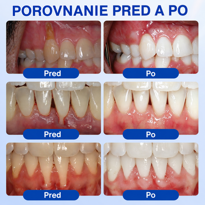👨‍⚕️🦷𝑷𝒖𝒓𝒂𝑪𝒖𝒓𝒆® 𝑶𝑩𝑵𝑶𝑽𝑨 Ď𝑨𝑺𝑰𝑬𝑵 𝑷𝒂𝒓𝒐𝒅𝒐𝒏𝒕á𝒍𝒏𝒚 𝒐𝒑𝒓𝒂𝒗𝒏ý 𝒈é𝒍✨